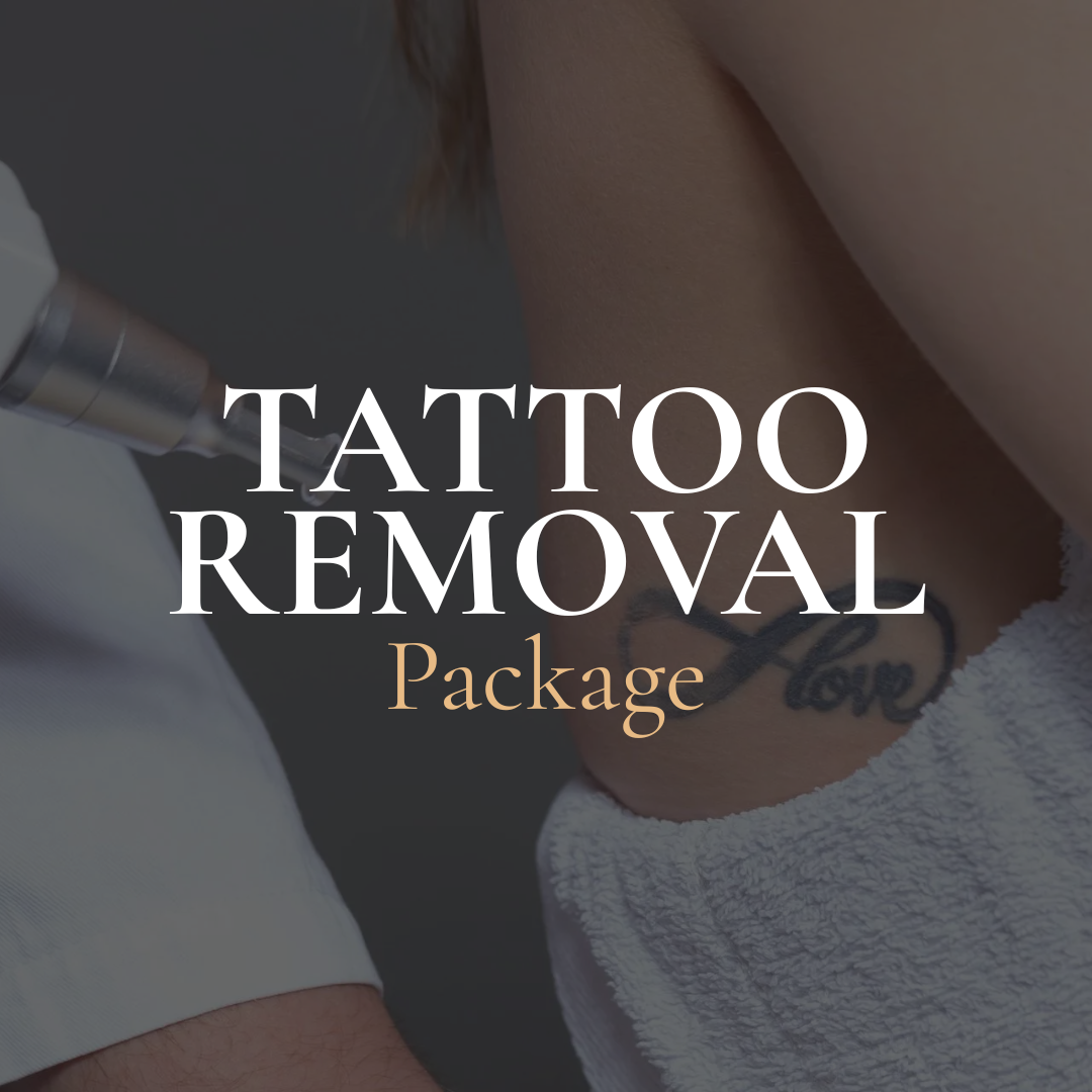 Laser Tattoo Removal Package 7 Sessions (Victoria, BC)