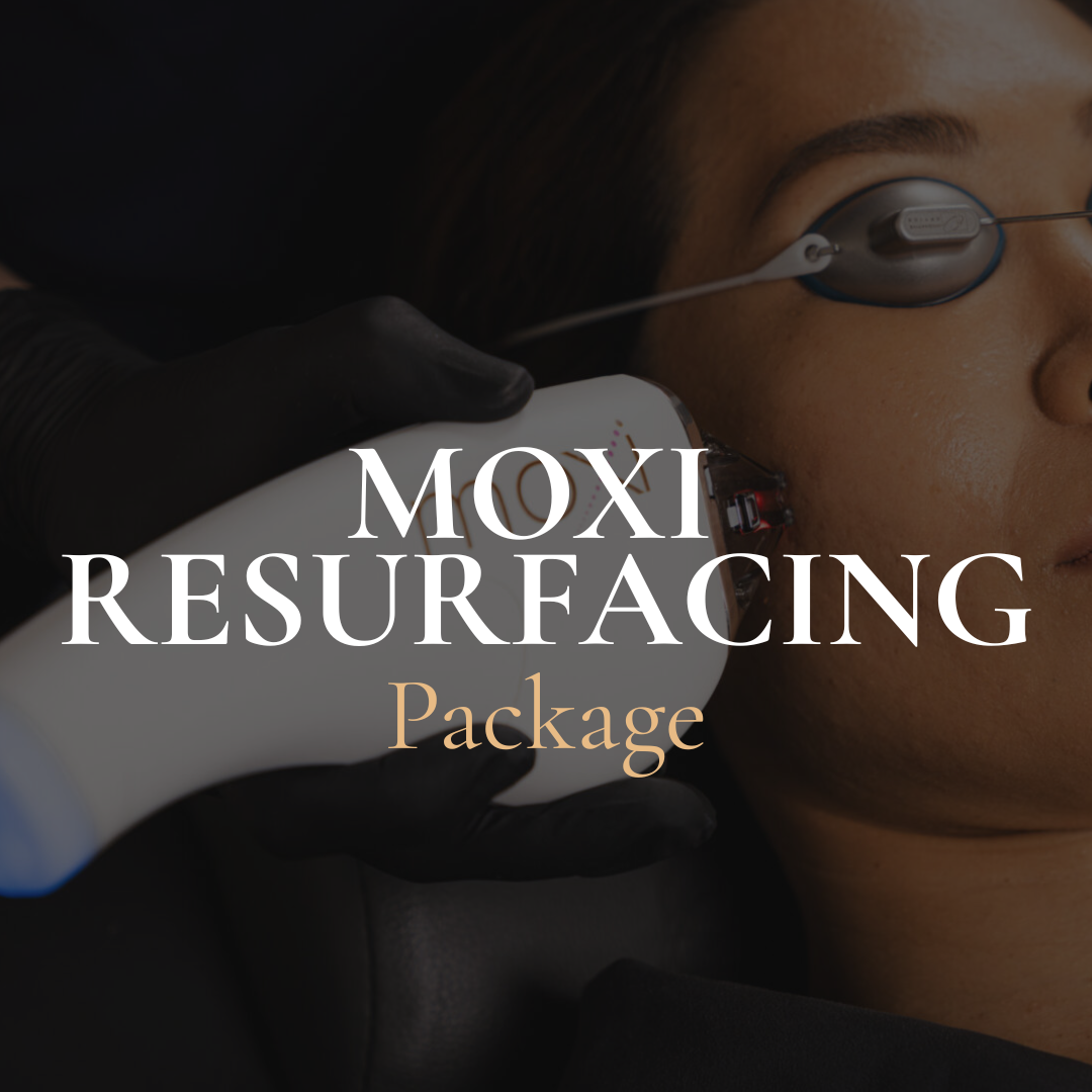 MOXI Laser Facial Package (Sidney, BC)