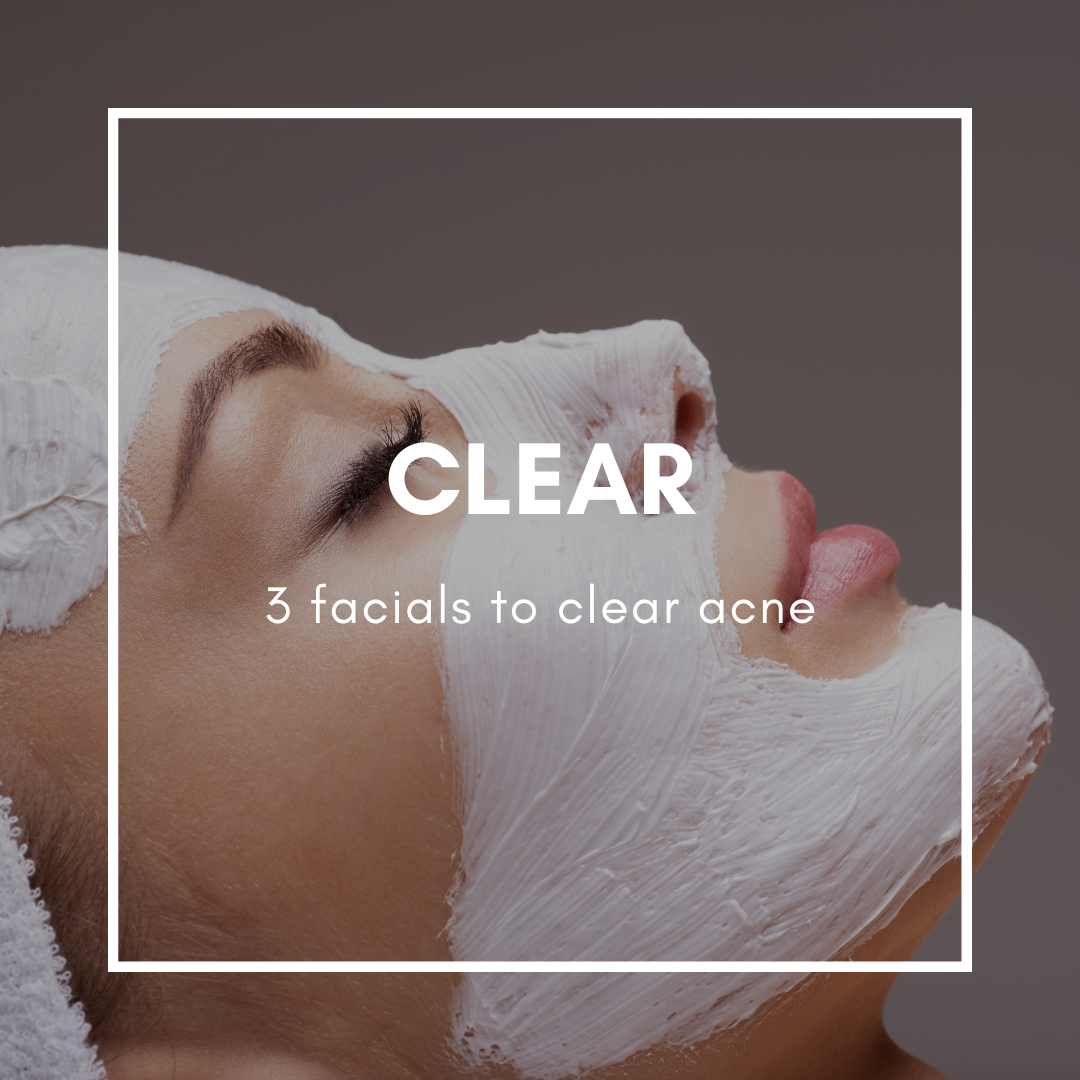 CLEAR Facial Package-the best acne facials in Victoria, BC