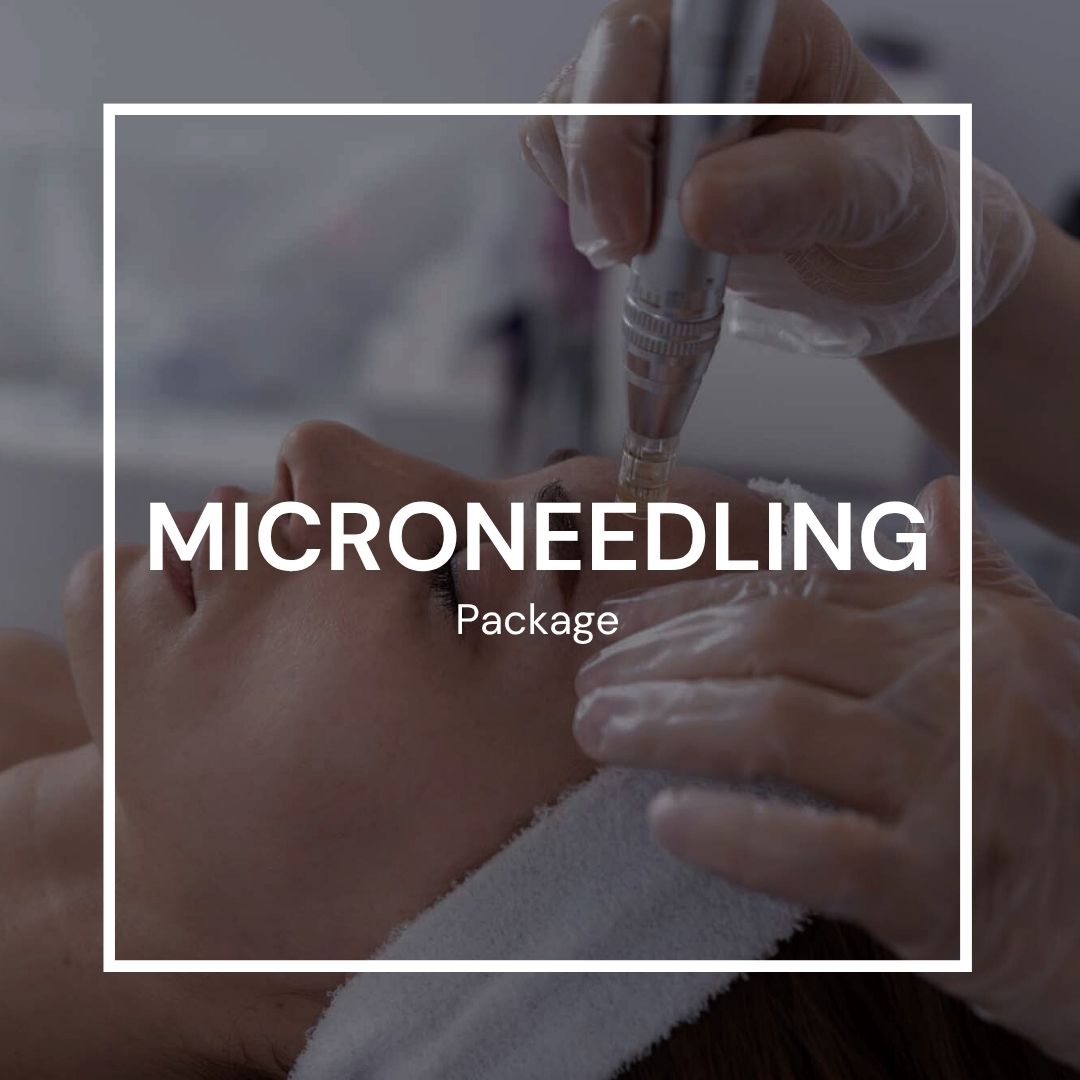 Microneedling Package (3 Sessions) - Best Microneedling in Victoria and Sidney BC