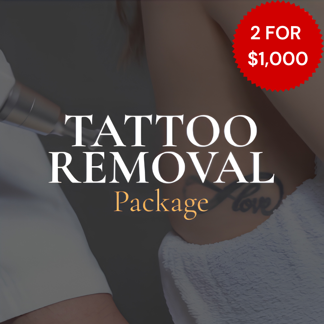 Laser Tattoo Removal Package 7 Sessions (Victoria, BC)